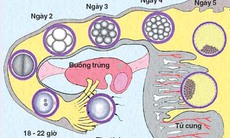 Tai sao có hiện tượng thai ngoài tử cung?